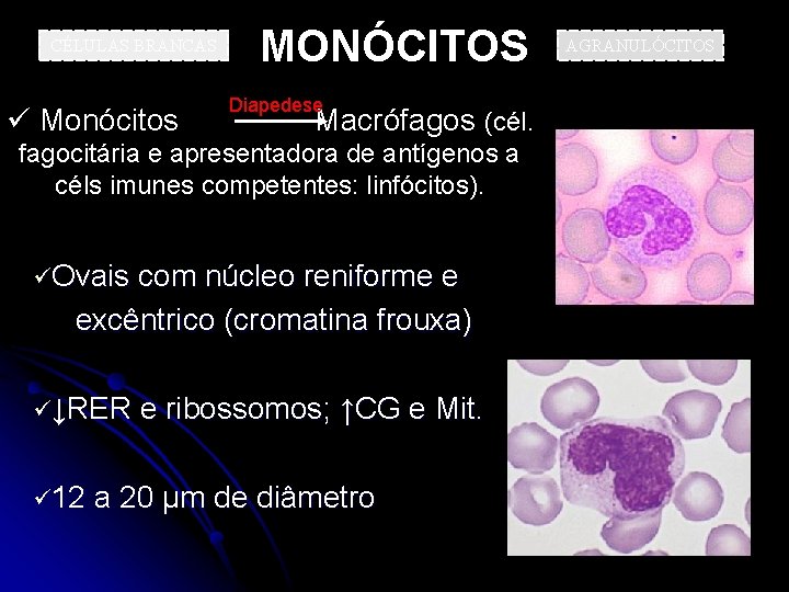 CÉLULAS BRANCAS MONÓCITOS Diapedese ü Monócitos Macrófagos (cél. fagocitária e apresentadora de antígenos a