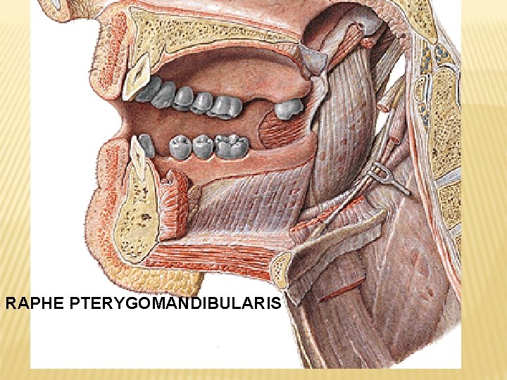 RAPHE PTERYGOMANDIBULARIS 