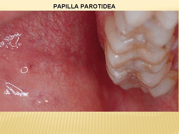 PAPILLA PAROTIDEA 