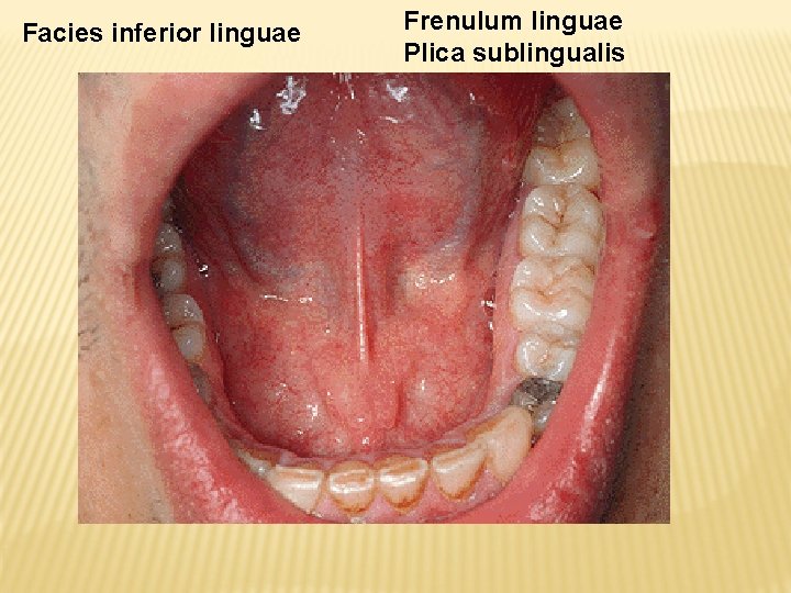 Facies inferior linguae Frenulum linguae Plica sublingualis 