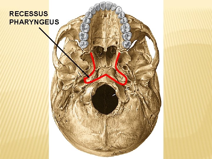 RECESSUS PHARYNGEUS 