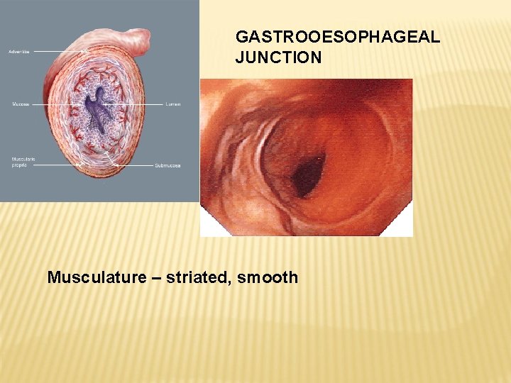 GASTROOESOPHAGEAL JUNCTION Musculature – striated, smooth 