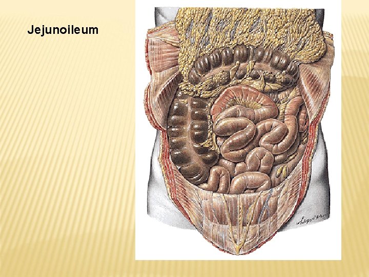 Jejunoileum 
