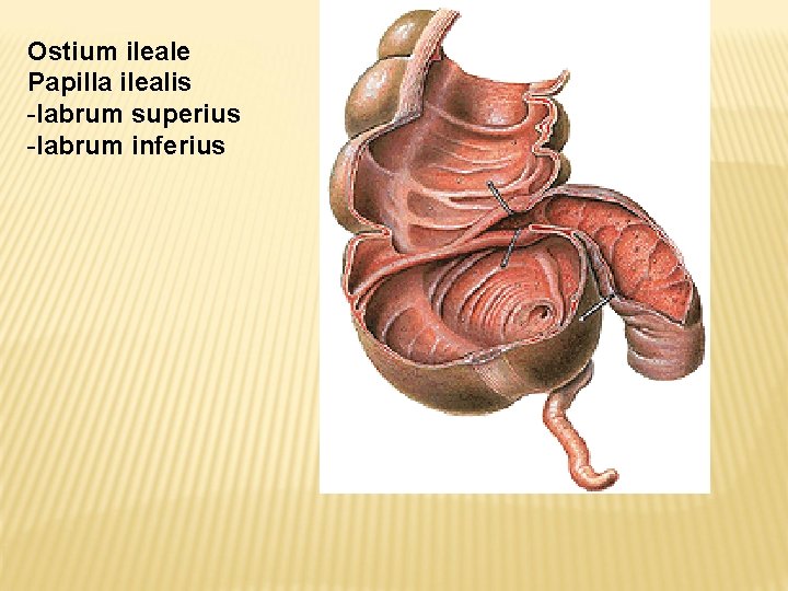 Ostium ileale Papilla ilealis -labrum superius -labrum inferius 
