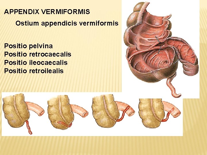 APPENDIX VERMIFORMIS Ostium appendicis vermiformis Positio pelvina Positio retrocaecalis Positio ileocaecalis Positio retroilealis 