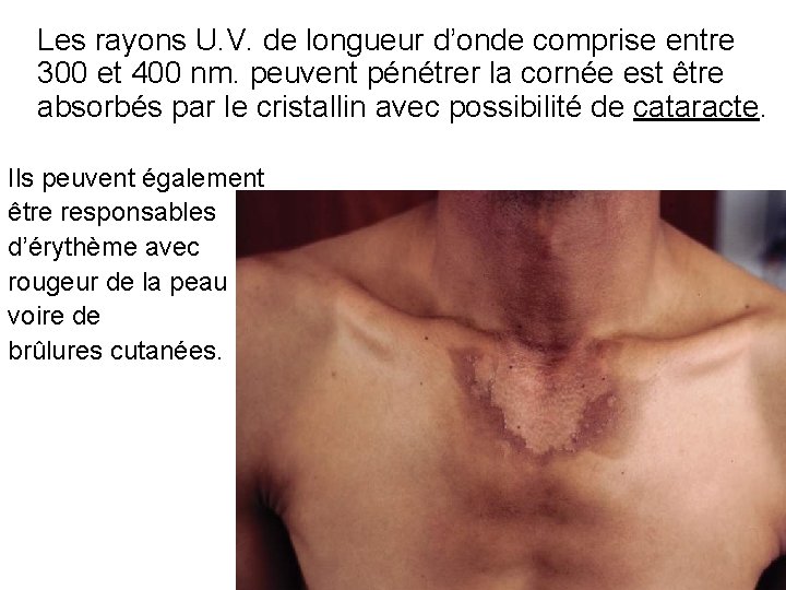 Les rayons U. V. de longueur d’onde comprise entre 300 et 400 nm. peuvent
