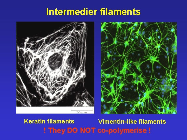 Intermedier filaments Keratin filaments Vimentin-like filaments ! They DO NOT co-polymerise ! 