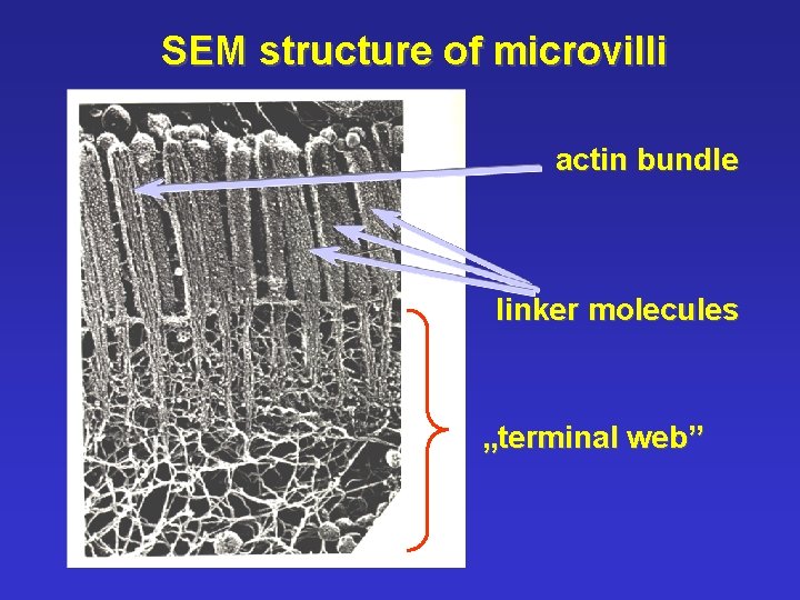 SEM structure of microvilli actin bundle linker molecules „terminal web” 