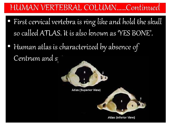 HUMAN VERTEBRAL COLUMN……Continued • First cervical vertebra is ring like and hold the skull