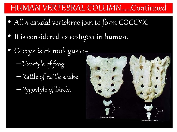 HUMAN VERTEBRAL COLUMN……Continued • All 4 caudal vertebrae join to form COCCYX. • It