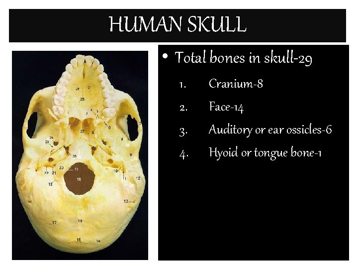 HUMAN SKULL • Total bones in skull-29 1. 2. 3. 4. Cranium-8 Face-14 Auditory