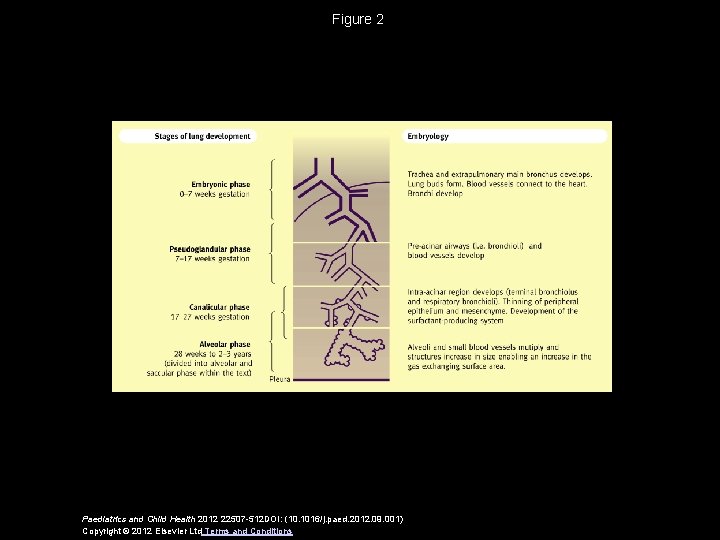 Figure 2 Paediatrics and Child Health 2012 22507 -512 DOI: (10. 1016/j. paed. 2012.