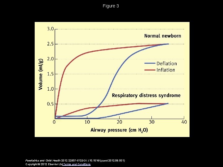 Figure 3 Paediatrics and Child Health 2012 22507 -512 DOI: (10. 1016/j. paed. 2012.