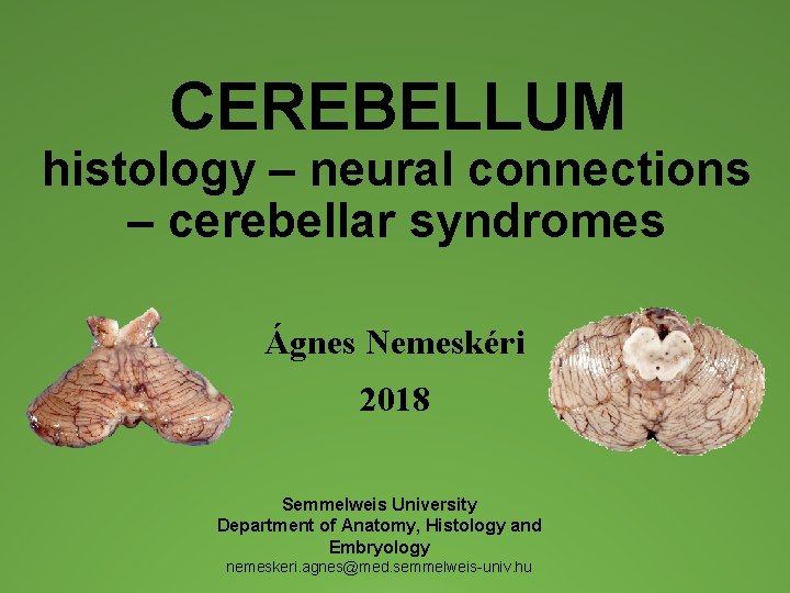 CEREBELLUM histology – neural connections – cerebellar syndromes Ágnes Nemeskéri 2018 Semmelweis University Department