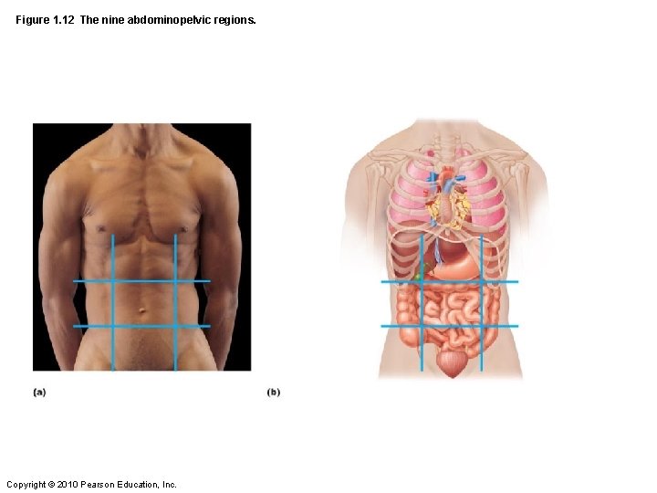 Figure 1. 12 The nine abdominopelvic regions. Copyright © 2010 Pearson Education, Inc. 