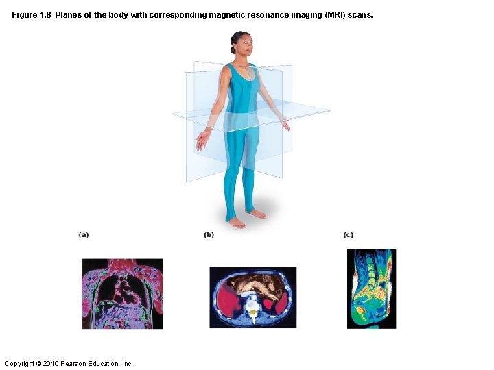 Figure 1. 8 Planes of the body with corresponding magnetic resonance imaging (MRI) scans.