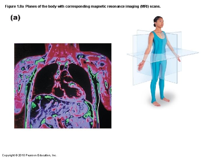 Figure 1. 8 a Planes of the body with corresponding magnetic resonance imaging (MRI)