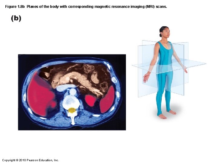 Figure 1. 8 b Planes of the body with corresponding magnetic resonance imaging (MRI)