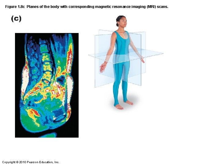 Figure 1. 8 c Planes of the body with corresponding magnetic resonance imaging (MRI)
