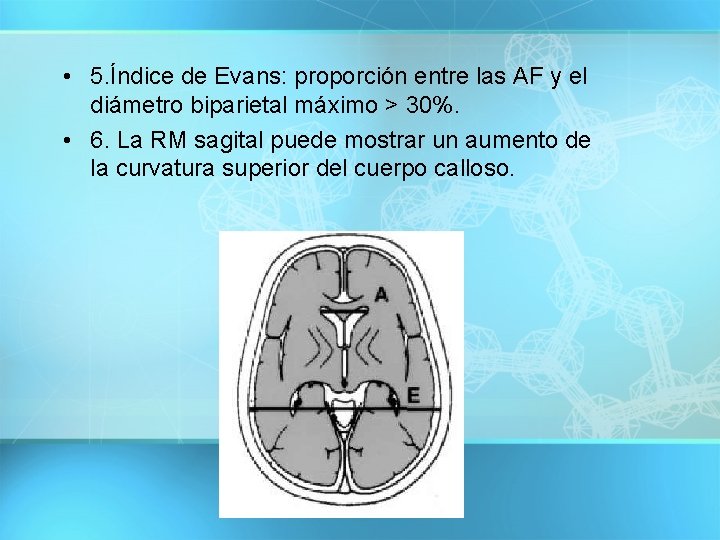  • 5. Índice de Evans: proporción entre las AF y el diámetro biparietal