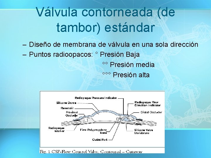 Válvula contorneada (de tambor) estándar – Diseño de membrana de válvula en una sola