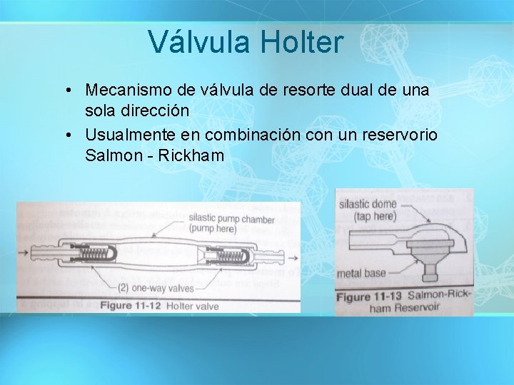 Válvula Holter • Mecanismo de válvula de resorte dual de una sola dirección •