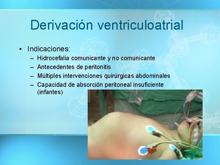 Derivación ventriculoatrial • Indicaciones: – – Hidrocefalia comunicante y no comunicante Antecedentes de peritonitis