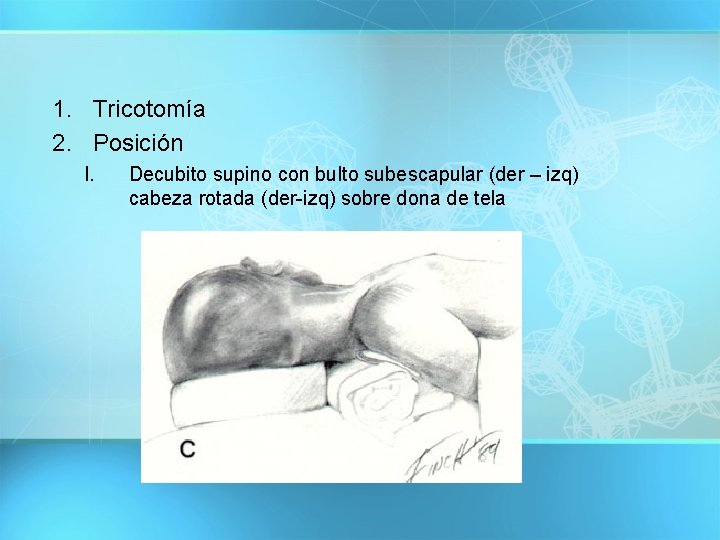 1. Tricotomía 2. Posición I. Decubito supino con bulto subescapular (der – izq) cabeza