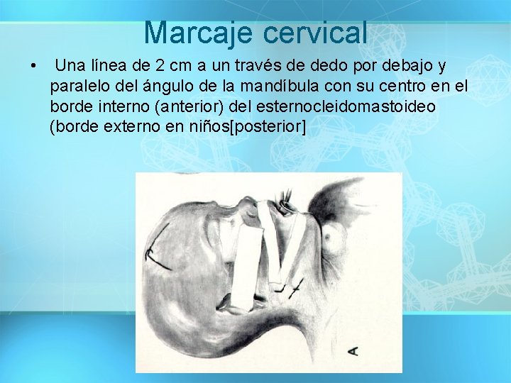 Marcaje cervical • Una línea de 2 cm a un través de dedo por