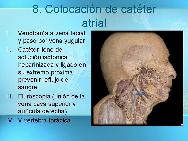 8. Colocación de catéter atrial I. Venotomía a vena facial y paso por vena