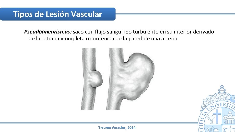 Tipos de Lesión Vascular Pseudoaneurismas: saco con flujo sanguíneo turbulento en su interior derivado Tipos de Lesión Vascular Pseudoaneurismas: saco con flujo sanguíneo turbulento en su interior derivado