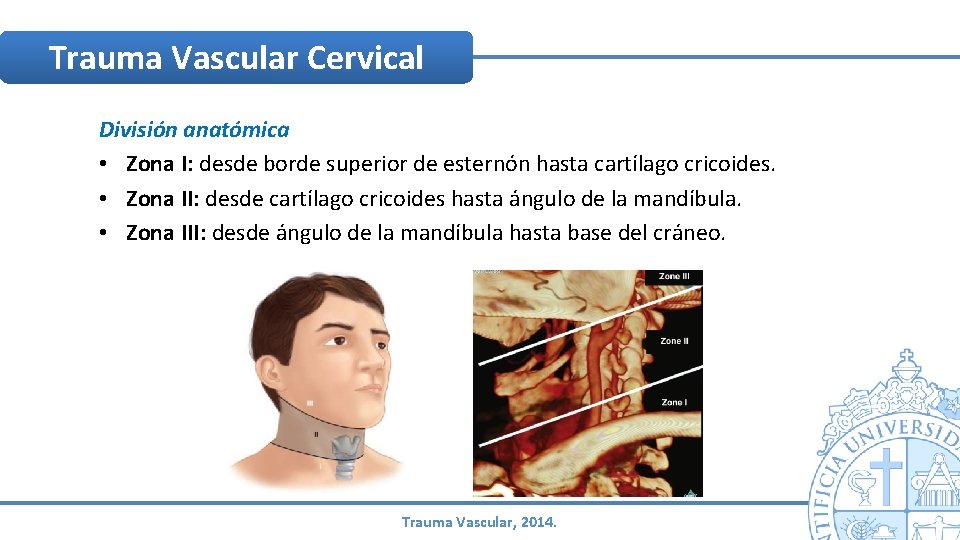 Trauma Vascular Cervical División anatómica • Zona I: desde borde superior de esternón hasta Trauma Vascular Cervical División anatómica • Zona I: desde borde superior de esternón hasta