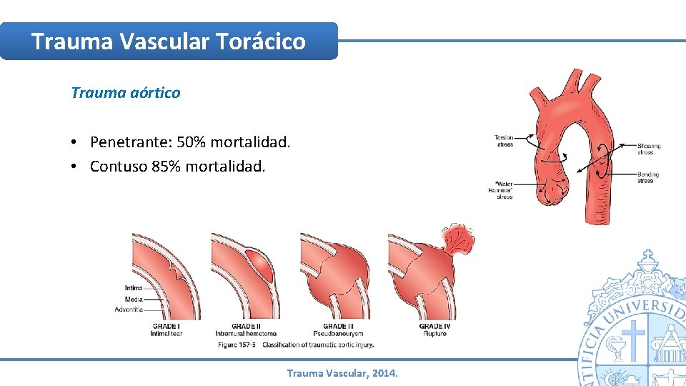 Trauma Vascular Torácico Trauma aórtico • Penetrante: 50% mortalidad. • Contuso 85% mortalidad. Trauma Trauma Vascular Torácico Trauma aórtico • Penetrante: 50% mortalidad. • Contuso 85% mortalidad. Trauma
