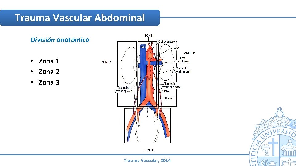 Trauma Vascular Abdominal División anatómica • Zona 1 • Zona 2 • Zona 3 Trauma Vascular Abdominal División anatómica • Zona 1 • Zona 2 • Zona 3