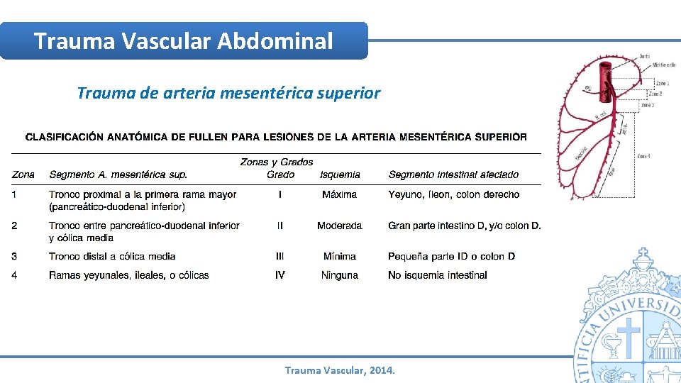 Trauma Vascular Abdominal Trauma de arteria mesentérica superior Trauma Vascular, 2014. Trauma Vascular Abdominal Trauma de arteria mesentérica superior Trauma Vascular, 2014.