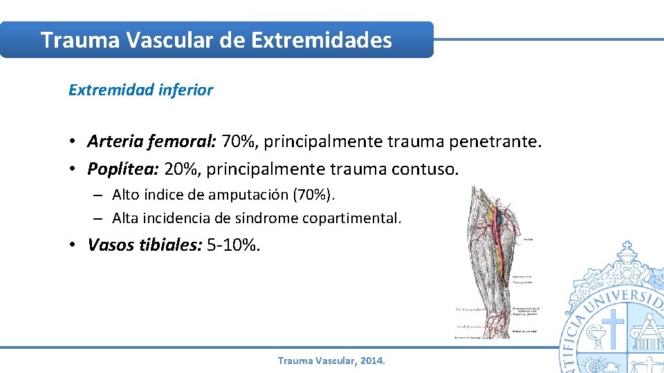 Trauma Vascular de Extremidades Extremidad inferior • Arteria femoral: 70%, principalmente trauma penetrante. • Trauma Vascular de Extremidades Extremidad inferior • Arteria femoral: 70%, principalmente trauma penetrante. •
