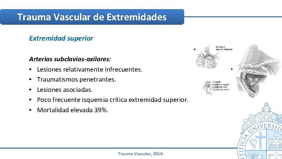 Trauma Vascular de Extremidades Extremidad superior Arterias subclavias-axilares: • Lesiones relativamente infrecuentes. • Traumatismos Trauma Vascular de Extremidades Extremidad superior Arterias subclavias-axilares: • Lesiones relativamente infrecuentes. • Traumatismos