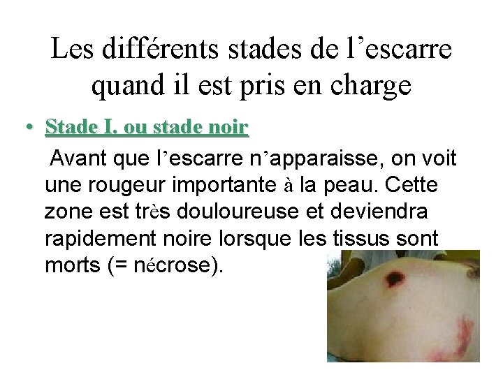 Les différents stades de l’escarre quand il est pris en charge • Stade I.