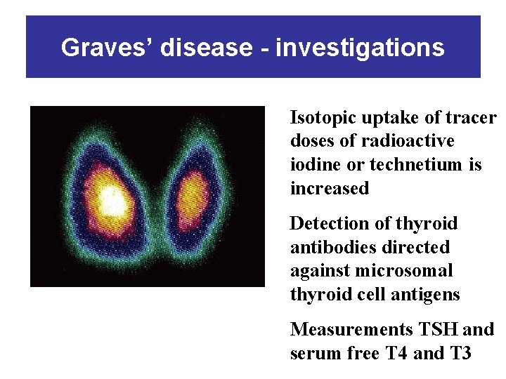 Graves’ disease - investigations Isotopic uptake of tracer doses of radioactive iodine or technetium