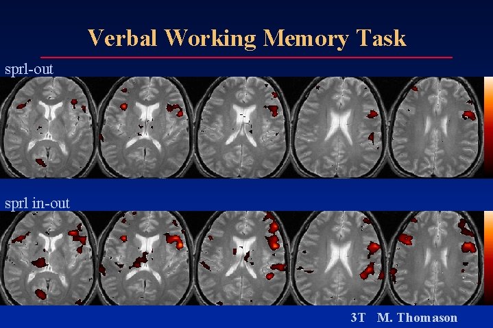 Verbal Working Memory Task sprl-out sprl in-out 3 T M. Thomason Verbal Working Memory Task sprl-out sprl in-out 3 T M. Thomason