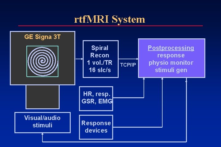 rtf. MRI System GE Signa 3 T Spiral Recon 1 vol. /TR 16 slc/s rtf. MRI System GE Signa 3 T Spiral Recon 1 vol. /TR 16 slc/s