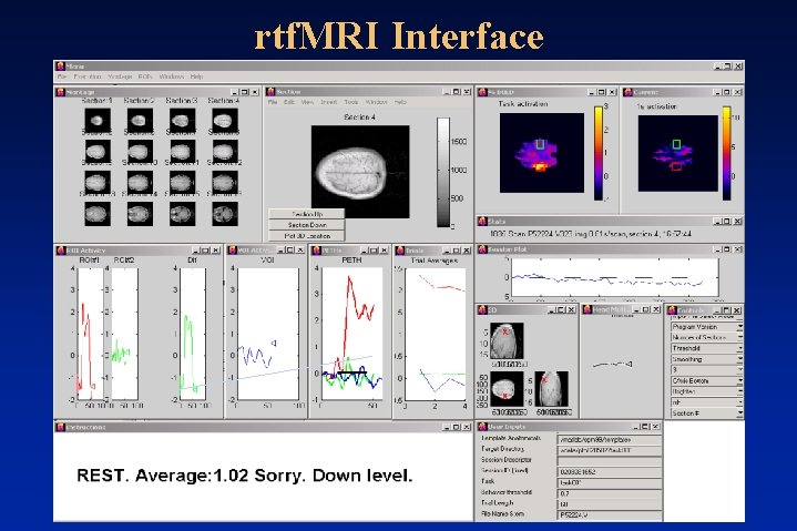 rtf. MRI Interface rtf. MRI Interface