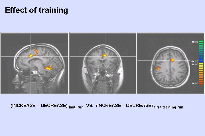 Effect of training (INCREASE – DECREASE) last run VS. (INCREASE – DECREASE) first training Effect of training (INCREASE – DECREASE) last run VS. (INCREASE – DECREASE) first training