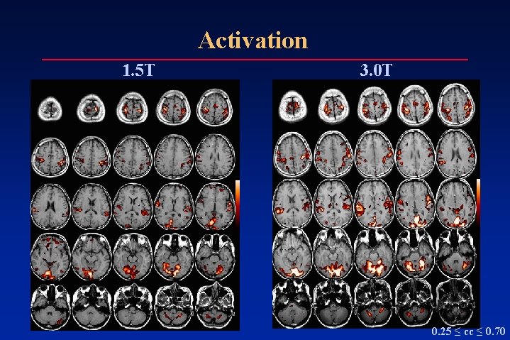 Activation 1. 5 T 3. 0 T 0. 25 ≤ cc ≤ 0. 70 Activation 1. 5 T 3. 0 T 0. 25 ≤ cc ≤ 0. 70