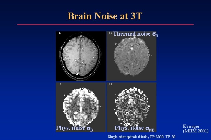 Brain Noise at 3 T Thermal noise 0 Phys. noise B Phys. noise NB Brain Noise at 3 T Thermal noise 0 Phys. noise B Phys. noise NB