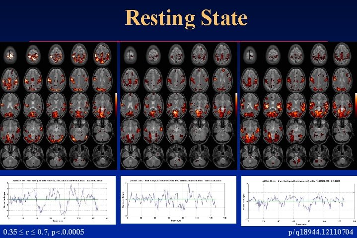Resting State 0. 35 ≤ r ≤ 0. 7, p<. 0. 0005 p/q 18944. Resting State 0. 35 ≤ r ≤ 0. 7, p<. 0. 0005 p/q 18944.