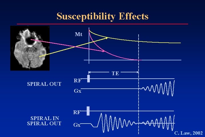 Susceptibility Effects Mt TE SPIRAL OUT RF Gx SPIRAL IN SPIRAL OUT RF Gx Susceptibility Effects Mt TE SPIRAL OUT RF Gx SPIRAL IN SPIRAL OUT RF Gx