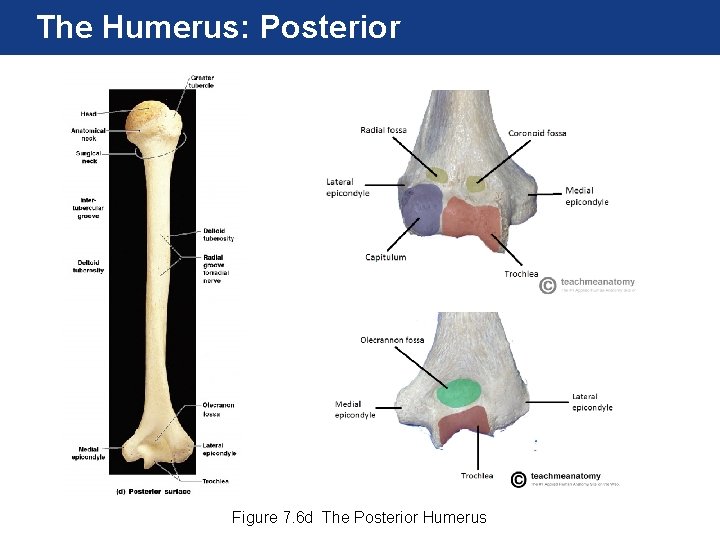 The Humerus: Posterior Figure 7. 6 d The Posterior Humerus The Humerus: Posterior Figure 7. 6 d The Posterior Humerus