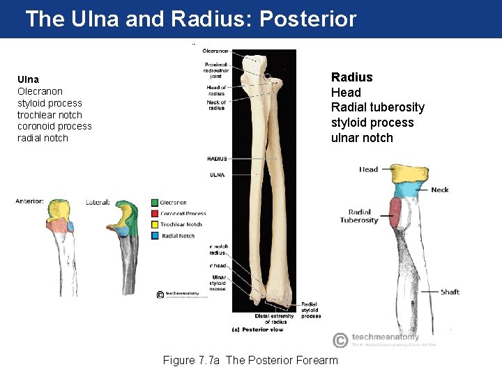 The Ulna and Radius: Posterior Ulna Olecranon styloid process trochlear notch coronoid process radial The Ulna and Radius: Posterior Ulna Olecranon styloid process trochlear notch coronoid process radial