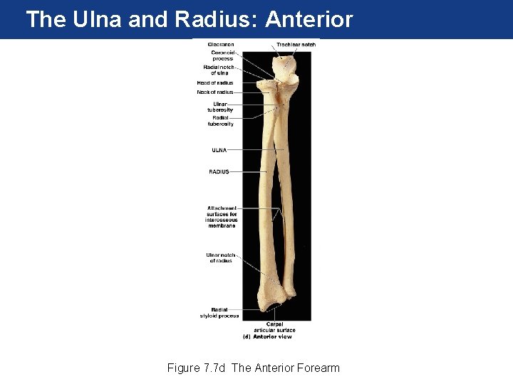 The Ulna and Radius: Anterior Figure 7. 7 d The Anterior Forearm The Ulna and Radius: Anterior Figure 7. 7 d The Anterior Forearm